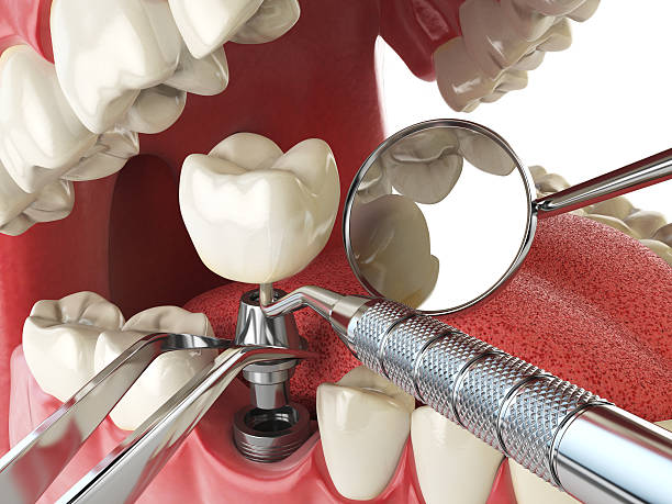Best Emergency Dental Extractions in Nowata, OK